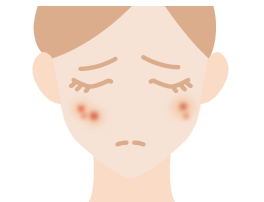 ニキビ・ニキビ痕